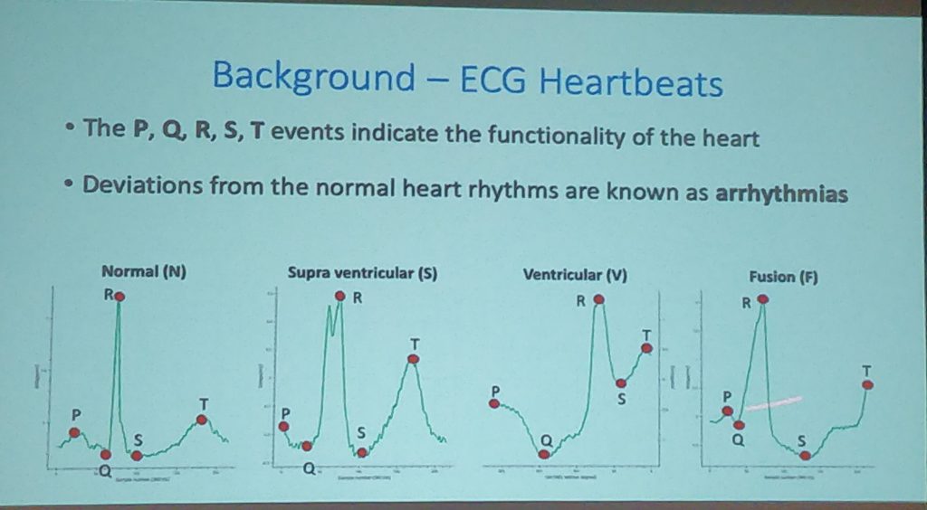 Heartbeats follow patterns, which allows the creation of synthetic datasets for data augmentation.